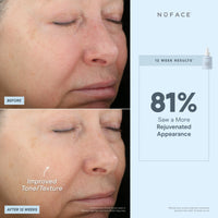 NUFACE protect&tighten super antioxidant booster serum