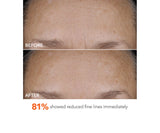 DR. DENNIS GROSS DERMINFUSIONS BLUR + REPAIR CREAM