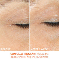 Dr. Dennis Gross Vitamin C+ Lactic Firm & Bright Eye Treatment